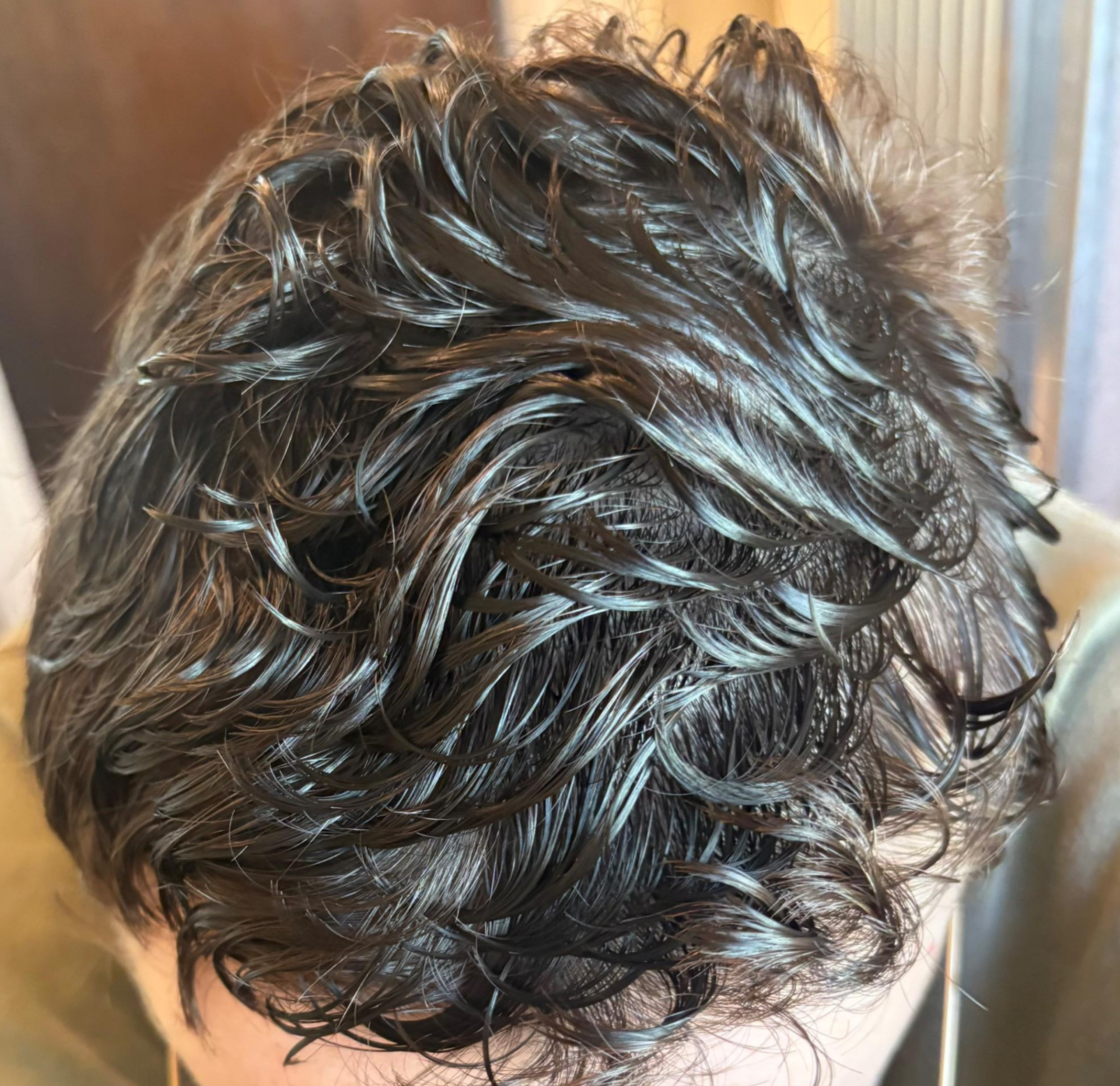 After - Scalp Health